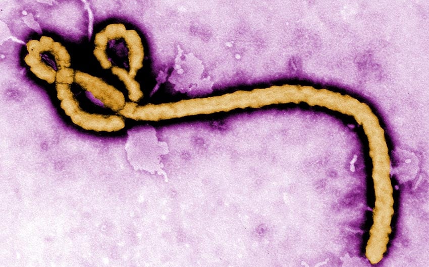 Ebola-Virus unter Elektronen-Mikroskop Quelle Webseite US Centers for Disease Control and Prevention CDC