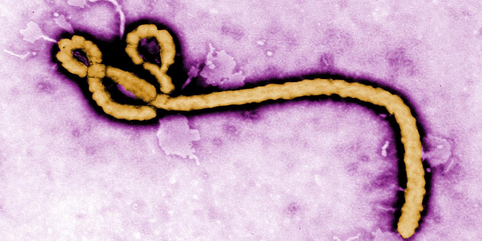 Ebola-Virus unter Elektronen-Mikroskop Quelle Webseite US Centers for Disease Control and Prevention CDC
